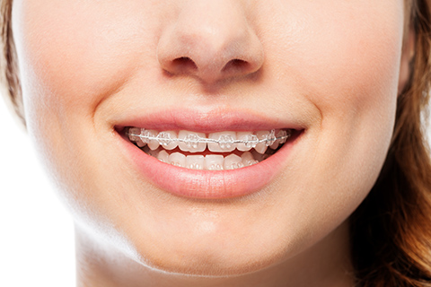 今からでも遅くない、大人の矯正治療