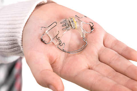 プレートを使った矯正治療