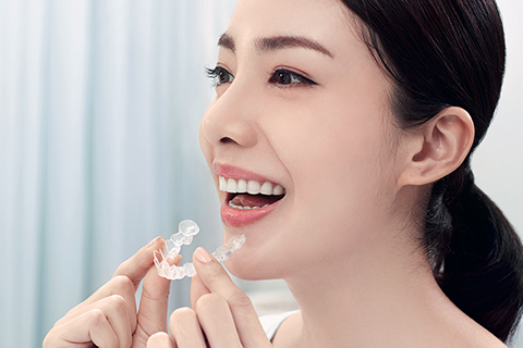 取り外せるマウスピース型カスタムメイド歯科矯正装置(インビザライン)による矯正治療とは