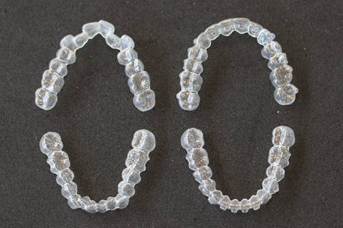 口腔内3Dスキャナー「iTero element(アイテロ エレメント)」を活用したシミュレーションによる円滑な治療