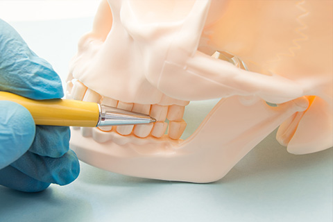 顎変形症・国の定めた先天性疾患